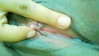 White pussy discharge