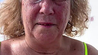 Putting Sunscreen on Every Last Freckle