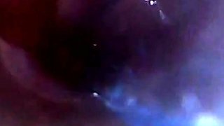 Endoscope POV Test Tube Cock Urethral Insertion