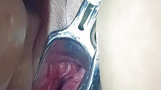 My hot wife&#039;s pussy is spread wide open by a speculum.