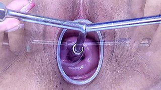Japanese Extreme Cervix Fucking
