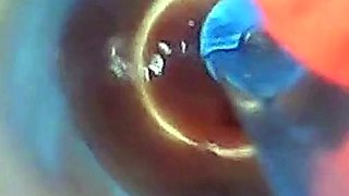 Endoscope POV: Test Tube Cock Urethral Insertion