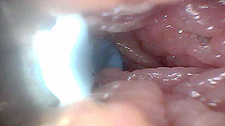Visual Guide to G-Spot Stimulation and Orgasm - Endoscopic Perspective