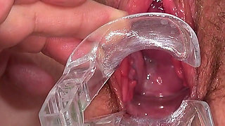 Big Hairy Pussy of Kaylea Tocnell Examined