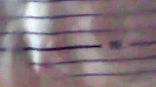 Modified Part 1 - Stapling up the Mangina