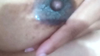 Nipples