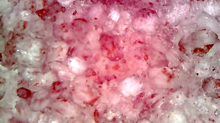 Medical Endoscope Oral Exam: Gummy Chewing, Extreme Teeth & Tongue Macro