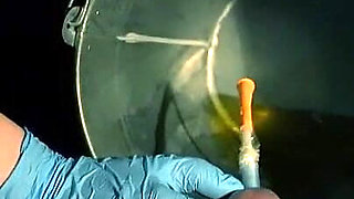 POV Patient. Sounding and Placing a Catheter