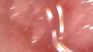 Medical Endoscope Oral Exam: Gummy Chewing, Extreme Teeth & Tongue Macro