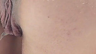 Pissing with a Huge Hemorrhoid in My Asshole Anal Problems