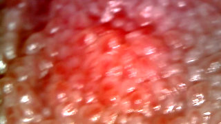 Medical Endoscope Oral Exam: Gummy Chewing, Extreme Teeth & Tongue Macro