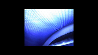 Speculum & Microcamera for Lady Soniac